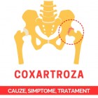 Coxartroza